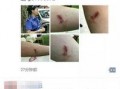 女子爆料城管打人视频大全